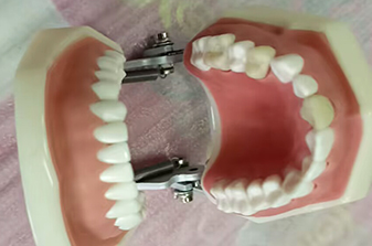 TM-G12 Oral X-Ray Model